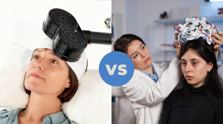 tms vs neurofeedback
